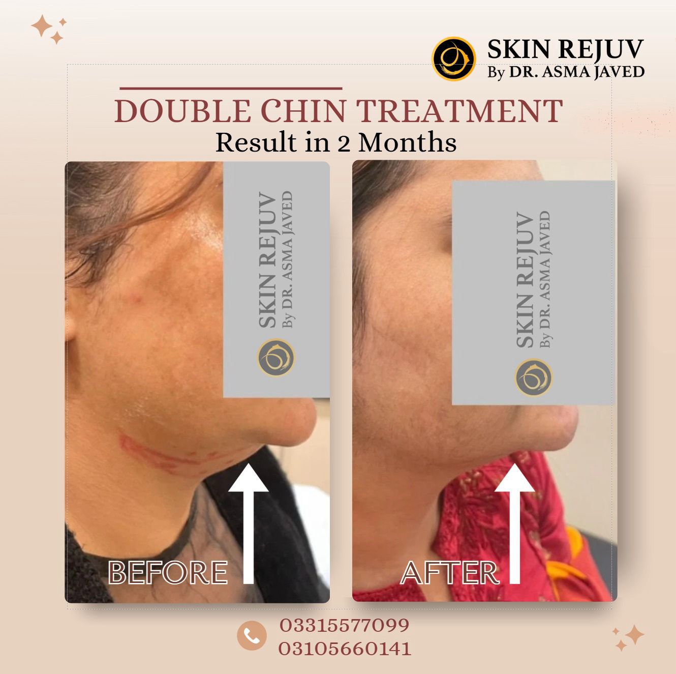 Before After Treatment 8